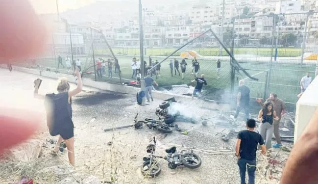 الزمالك يواجه المقاولون «الجريح»