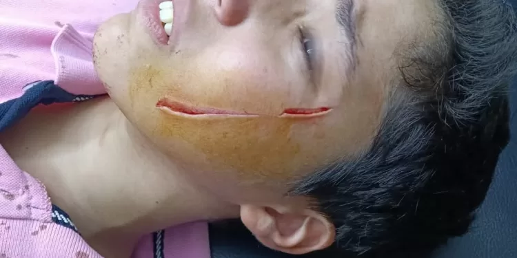 اعتداء بمشرط في مدرسة بالبدرشين: طالب يطعن زميله بسبب الغش 1 - جريدة الجمهورية اعتداء بمشرط في مدرسة بالبدرشين: طالب يطعن زميله بسبب الغش