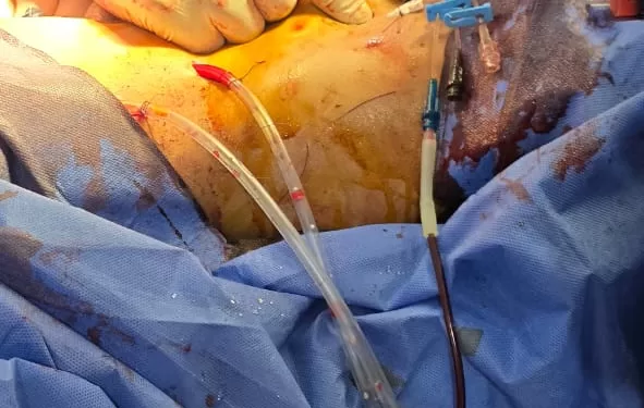 تدخل طبي عاجل ينقذ مراهقًا من الموت بعد إصابته في حادث مروري بالدقهلية 1 - جريدة الجمهورية «إعلام السويس» تُطلق «ملهم».. لتسليط الضوء على النماذج الناجحة