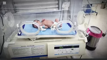 ميت غمر: فريق طبي يجري جراحة دقيقة وينقذ «رضيعًا» بأمعاء خارج الجسم 3 - جريدة الجمهورية 4 21 - جريدة الجمهورية