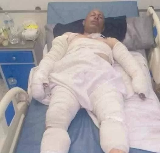توفي متأثرًا بحروقه.. قائد شجاع ينقذ العاشر من رمضان من كارثة 2 - جريدة الجمهورية WhatsApp Image 2025 06 08 at 4.42.11 PM - جريدة الجمهورية