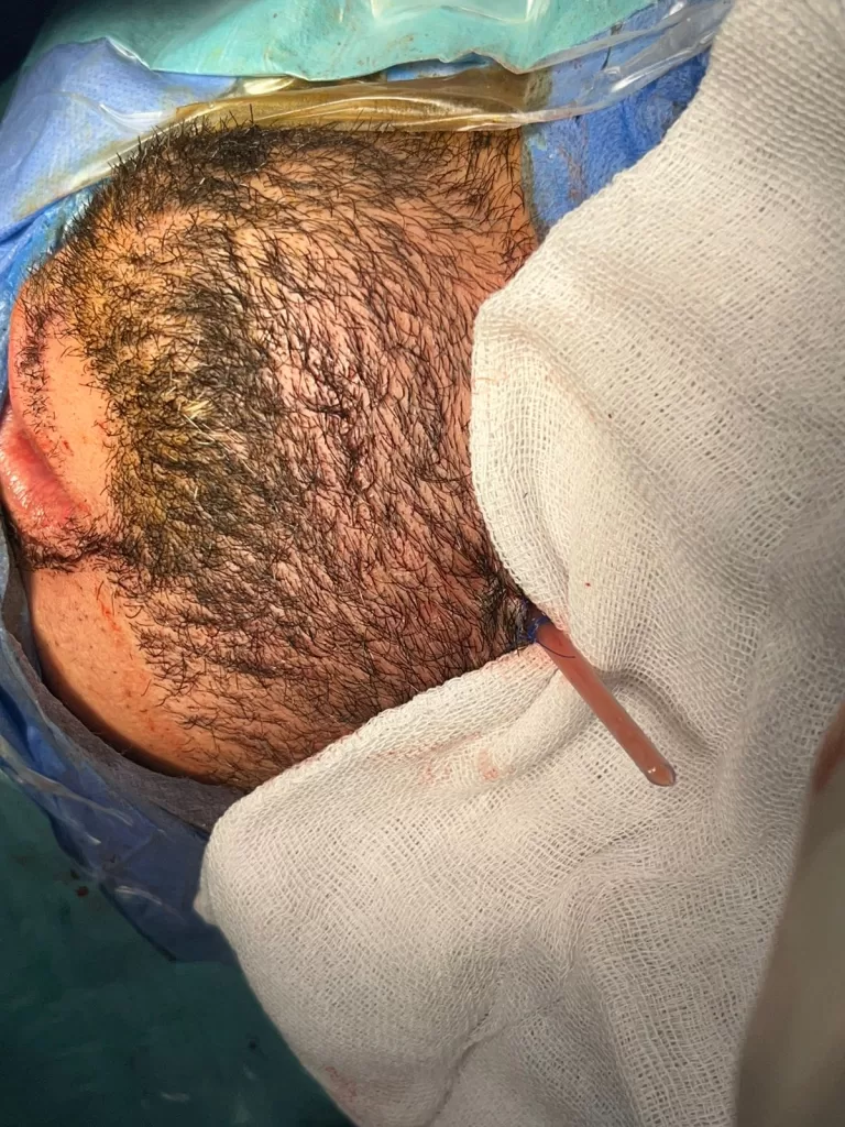 الدقهلية: إنقاذ حياة مريض كاد يفقدها بسبب خراج ضرس حاد 2 - جريدة الجمهورية WhatsApp Image 2025 06 16 at 15.11.03 61398d69 - جريدة الجمهورية