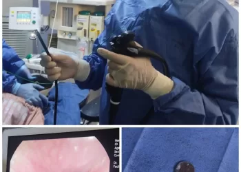 إنقاذ طفلة ابتلعت عملة معدنية في الشرقية 4 - جريدة الجمهورية إنقاذ طفلة ابتلعت عملة معدنية في الشرقية