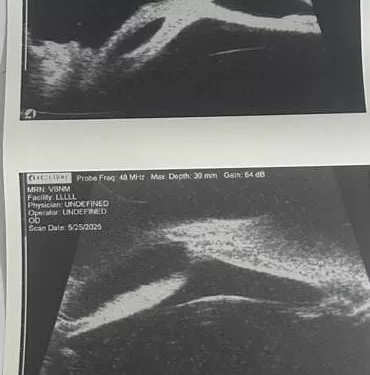 تشغيل أحدث جهاز UBM للتشخيص الدقيق بمستشفى رمد المنصورة 1 - جريدة الجمهورية تشغيل أحدث جهاز UBM للتشخيص الدقيق بمستشفى رمد المنصورة
