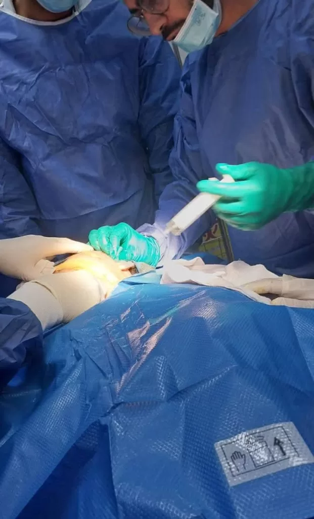 إنقاذ حياة مريض من «الإغلاق القسري».. جراحة دقيقة بمفصل الفك في مستشفى الشروق 2 - جريدة الجمهورية WhatsApp Image 2025 09 30 at 21.06.13 750f55a5 - جريدة الجمهورية
