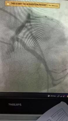 «صحة الدقهلية» تنجح في إنقاذ حياة مريضة جلطة قلبية في وقت قياسي 2 - جريدة الجمهورية 2 56 - جريدة الجمهورية