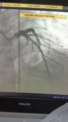 «صحة الدقهلية» تنجح في إنقاذ حياة مريضة جلطة قلبية في وقت قياسي 3 - جريدة الجمهورية 3 49 - جريدة الجمهورية