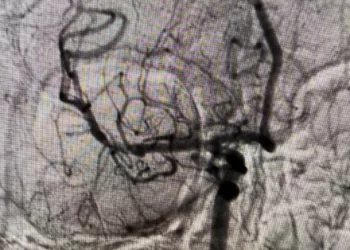 إنقاذ 4 حالات حرجة.. وحدات السكتات الدماغية بالدقهلية تسجل نجاحات متوالية