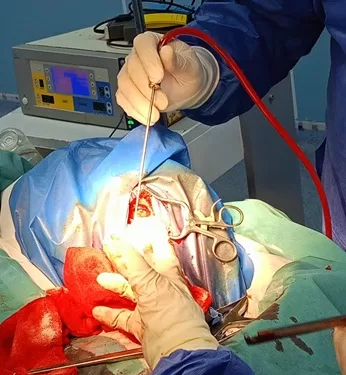 نجاح جراحة دقيقة باستخدام «جراحة اليقظة» بمستشفى أجا