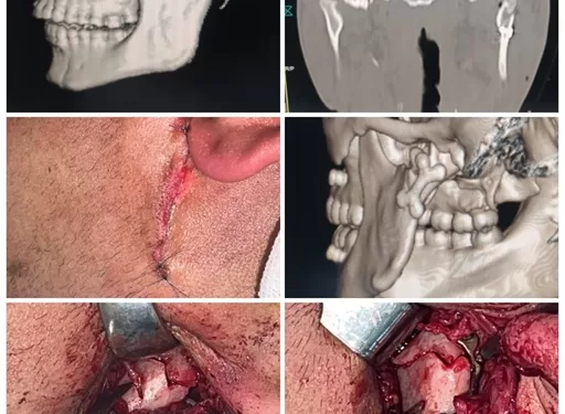 اليوبيل الذهبي للنجاح.. مستشفى شربين المركزي يُتم العملية رقم 50 في جراحة الوجه والفكين 1 - جريدة الجمهورية اليوبيل الذهبي للنجاح.. مستشفى شربين المركزي يُتم العملية رقم 50 في جراحة الوجه والفكين