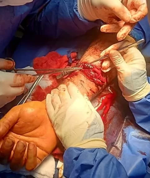 تدخل جراحي دقيق ينقذ ذراع مريض من «البتر» بمستشفى أجا المركزي 3 - جريدة الجمهورية WhatsApp Image 2026 01 25 at 10.25.41 PM 1 - جريدة الجمهورية