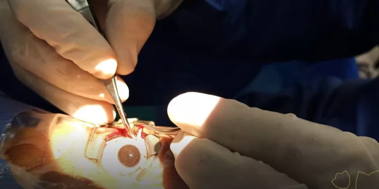 مجمع السويس الطبي يحقق نجاحًا جديدًا في جراحات تصحيح الحول للأطفال 1 - جريدة الجمهورية مجمع السويس الطبي يحقق نجاحًا جديدًا في جراحات تصحيح الحول للأطفال