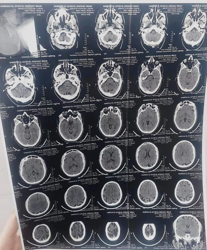 في «الوقت الذهبي».. مستشفى السنبلاوين العام ينقذ 3 حالات من السكتة الدماغية 2 - جريدة الجمهورية WhatsApp Image 2026 02 21 at 2.54.02 PM - جريدة الجمهورية