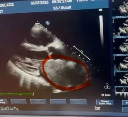 11 14 - جريدة الجمهورية