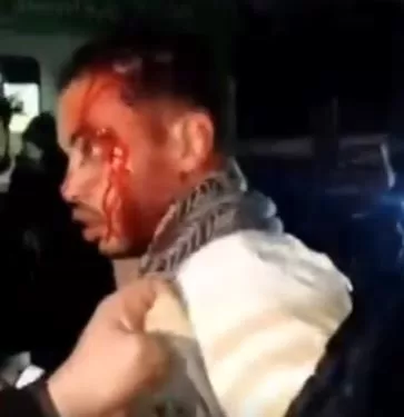 عاتبهم فطعنوه.. الأمن يفحص فيديو اعتداء «شخصين» على شاب بسلاح أبيض بمدينة نصر 1 - جريدة الجمهورية عاتبهم فطعنوه.. الأمن يفحص فيديو اعتداء «شخصين» على شاب بسلاح أبيض بمدينة نصر