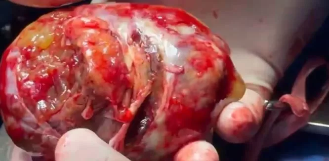 6 34 - جريدة الجمهورية