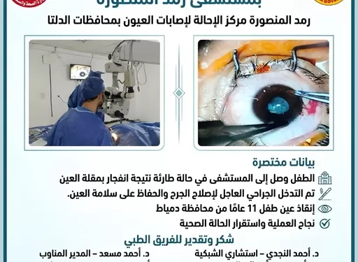 إنجاز طبي بمستشفى رمد المنصورة: إنقاذ عين طفل من فقدان البصر بعد إصابة خطيرة