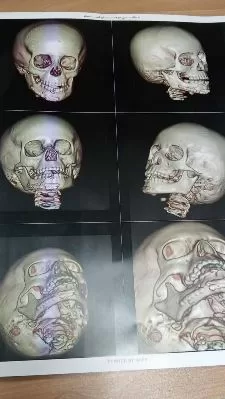 2 2 - جريدة الجمهورية