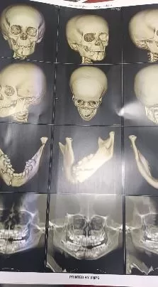 3 2 - جريدة الجمهورية