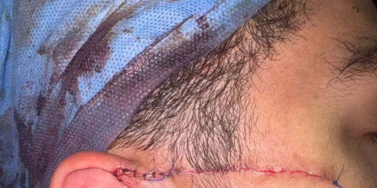 على باب المدرسة.. طالب يشج وجه زميله بـ«كتر» 1 - جريدة الجمهورية على باب المدرسة.. طالب يشج وجه زميله بـ«كتر»