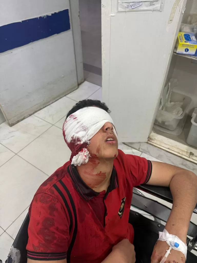 على باب المدرسة.. طالب يشج وجه زميله بـ«كتر» 3 - جريدة الجمهورية WhatsApp Image 2026 05 15 at 12.21.08 PM - جريدة الجمهورية