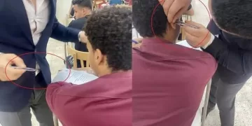 استخراج سماعة غش من أذن طالب بـ «ملقاط» في حقوق أسيوط