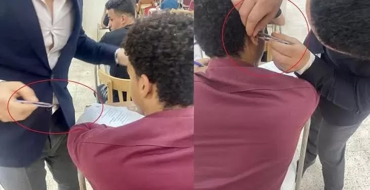 استخراج سماعة غش من أذن طالب بـ «ملقاط» في حقوق أسيوط