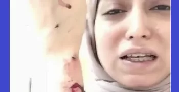 القبض على المتهمين بالتعدي على طبيبة أسنان بشبرا الخيمة وإحالتهم للنيابة