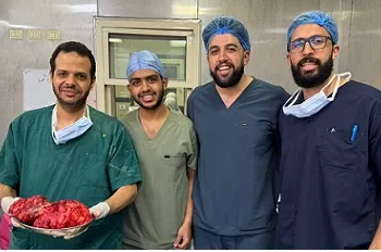 فريق طبي بـ قصر العيني ينجح في استئصال ورم يزن 9 كجم من مريض ستيني