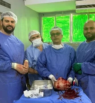 إنجاز طبي جديد بالفيوم.. استئصال ورم يزن ٥ كيلوجرامات من مبيض سيدة بمستشفى العام 2 - جريدة الجمهورية 7 4 - جريدة الجمهورية