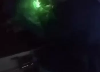 إنجاز طبي جديد.. نجاح علاج طفل مبتسر مصاب باعتلال الشبكية في “رمد المنصورة”