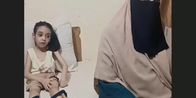 من الاستغاثة إلى الاستجابة الفورية .. محافظ بورسعيد: علاج الطفلة «فريدة» ومساعدة أسرتها مالياً